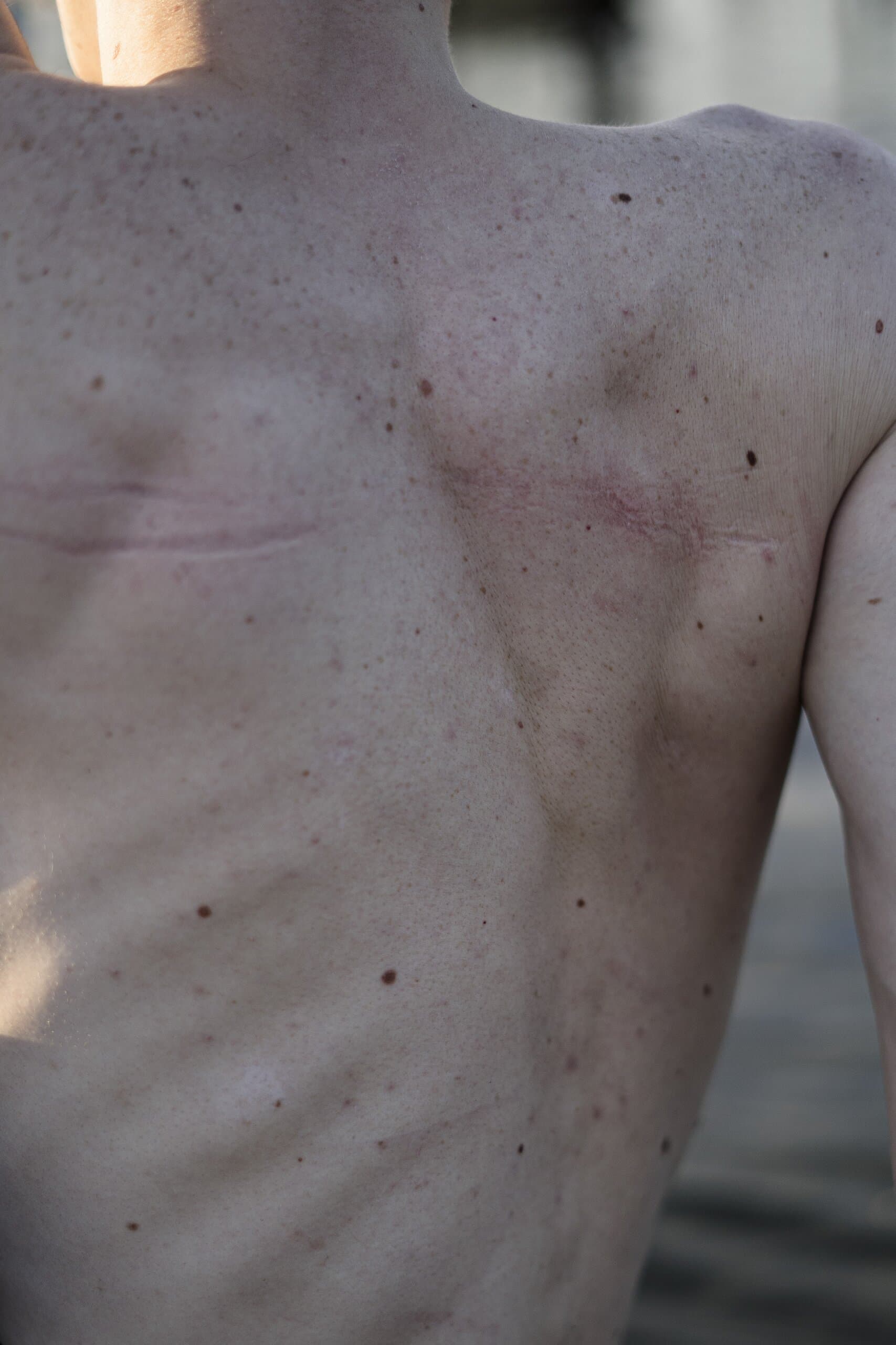 Close up: a bare back and shoulder blade in soft light.
